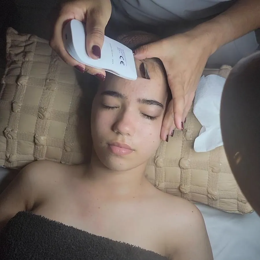 Miniatura del video Facial control Acné